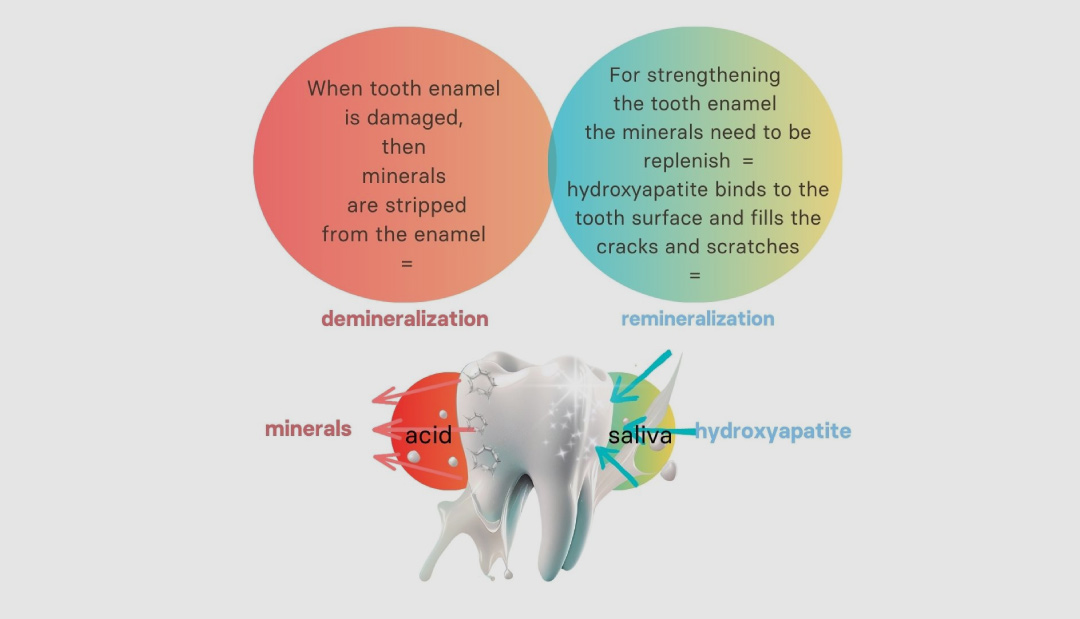 Remineralization